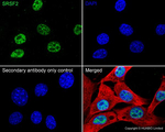 SRSF2 Antibody in Immunocytochemistry (ICC/IF)