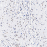 SRSF2 Antibody in Immunohistochemistry (Paraffin) (IHC (P))