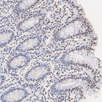 SRSF2 Antibody in Immunohistochemistry (Paraffin) (IHC (P))