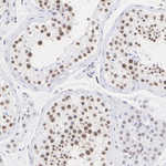 SRSF2 Antibody in Immunohistochemistry (Paraffin) (IHC (P))