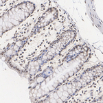SRSF2 Antibody in Immunohistochemistry (Paraffin) (IHC (P))