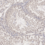 SRSF2 Antibody in Immunohistochemistry (Paraffin) (IHC (P))
