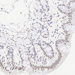SRSF2 Antibody in Immunohistochemistry (Paraffin) (IHC (P))