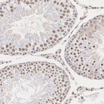 SRSF2 Antibody in Immunohistochemistry (Paraffin) (IHC (P))