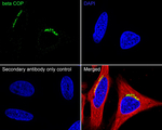 beta COP Antibody in Immunocytochemistry (ICC/IF)