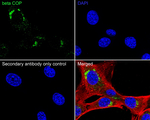 beta COP Antibody in Immunocytochemistry (ICC/IF)