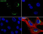 beta COP Antibody in Immunocytochemistry (ICC/IF)