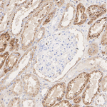 Cathepsin C Recombinant Rabbit Monoclonal Antibody (PSH19-36)