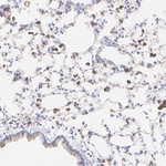 Cathepsin C  Antibody in Immunohistochemistry (Paraffin) (IHC (P))