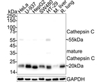 Cathepsin C  Antibody in Western Blot (WB)
