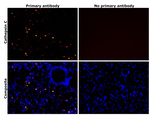 Cathepsin C  Antibody in Immunohistochemistry (IHC)