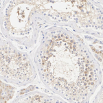 TMEM106B Antibody in Immunohistochemistry (Paraffin) (IHC (P))