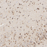 TMEM106B Antibody in Immunohistochemistry (Paraffin) (IHC (P))