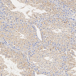 TMEM106B Recombinant Rabbit Monoclonal Antibody (PSH19-19)