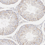 TMEM106B Antibody in Immunohistochemistry (Paraffin) (IHC (P))