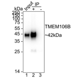 TMEM106B Antibody in Immunoprecipitation (IP)