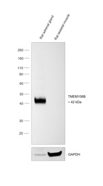 TMEM106B Antibody in Western Blot (WB)