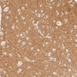 SLC8A1 Antibody in Immunohistochemistry (Paraffin) (IHC (P))
