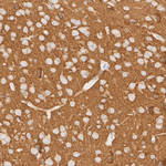 SLC8A1 Antibody in Immunohistochemistry (Paraffin) (IHC (P))