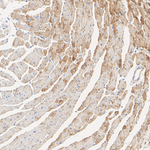 SLC8A1 Recombinant Rabbit Monoclonal Antibody (PSH20-37)