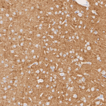 SLC8A1 Antibody in Immunohistochemistry (Paraffin) (IHC (P))