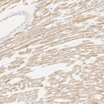 SLC8A1 Antibody in Immunohistochemistry (Paraffin) (IHC (P))
