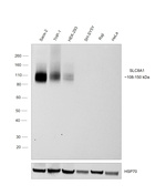 SLC8A1 Antibody