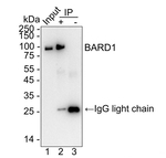 BARD1  Antibody in Immunoprecipitation (IP)
