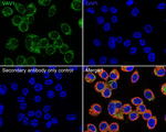 VAV1 Recombinant Rabbit Monoclonal Antibody (PSH21-73)