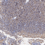 VAV1  Antibody in Immunohistochemistry (Paraffin) (IHC (P))