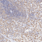 VAV1  Antibody in Immunohistochemistry (Paraffin) (IHC (P))