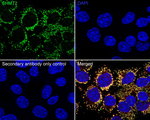 SHMT2 Recombinant Rabbit Monoclonal Antibody (PSH19-37)
