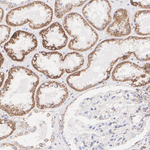 SHMT2  Antibody in Immunohistochemistry (Paraffin) (IHC (P))