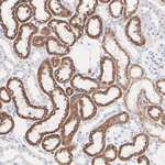 SHMT2  Antibody in Immunohistochemistry (Paraffin) (IHC (P))