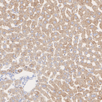 SHMT2  Antibody in Immunohistochemistry (Paraffin) (IHC (P))
