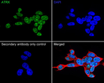 ATRX Antibody in Immunocytochemistry (ICC/IF)
