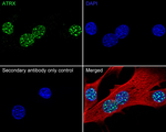 ATRX Antibody in Immunocytochemistry (ICC/IF)