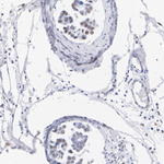 ATRX Antibody in Immunohistochemistry (Paraffin) (IHC (P))