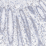 ATRX Antibody in Immunohistochemistry (Paraffin) (IHC (P))