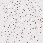 ATRX Antibody in Immunohistochemistry (Paraffin) (IHC (P))