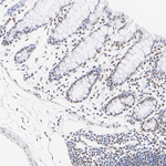 ATRX Antibody in Immunohistochemistry (Paraffin) (IHC (P))