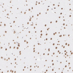 ATRX Antibody in Immunohistochemistry (Paraffin) (IHC (P))