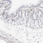 ATRX Antibody in Immunohistochemistry (Paraffin) (IHC (P))