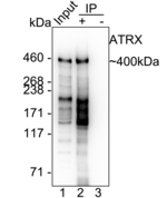 ATRX Antibody in Immunoprecipitation (IP)