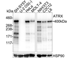 ATRX Antibody in Western Blot (WB)
