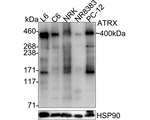 ATRX Antibody in Western Blot (WB)