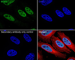 MTA1 Antibody in Immunocytochemistry (ICC/IF)