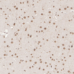 MTA1 Antibody in Immunohistochemistry (Paraffin) (IHC (P))