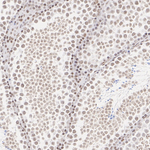 MTA1 Antibody in Immunohistochemistry (Paraffin) (IHC (P))