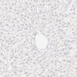 MTA1 Antibody in Immunohistochemistry (Paraffin) (IHC (P))